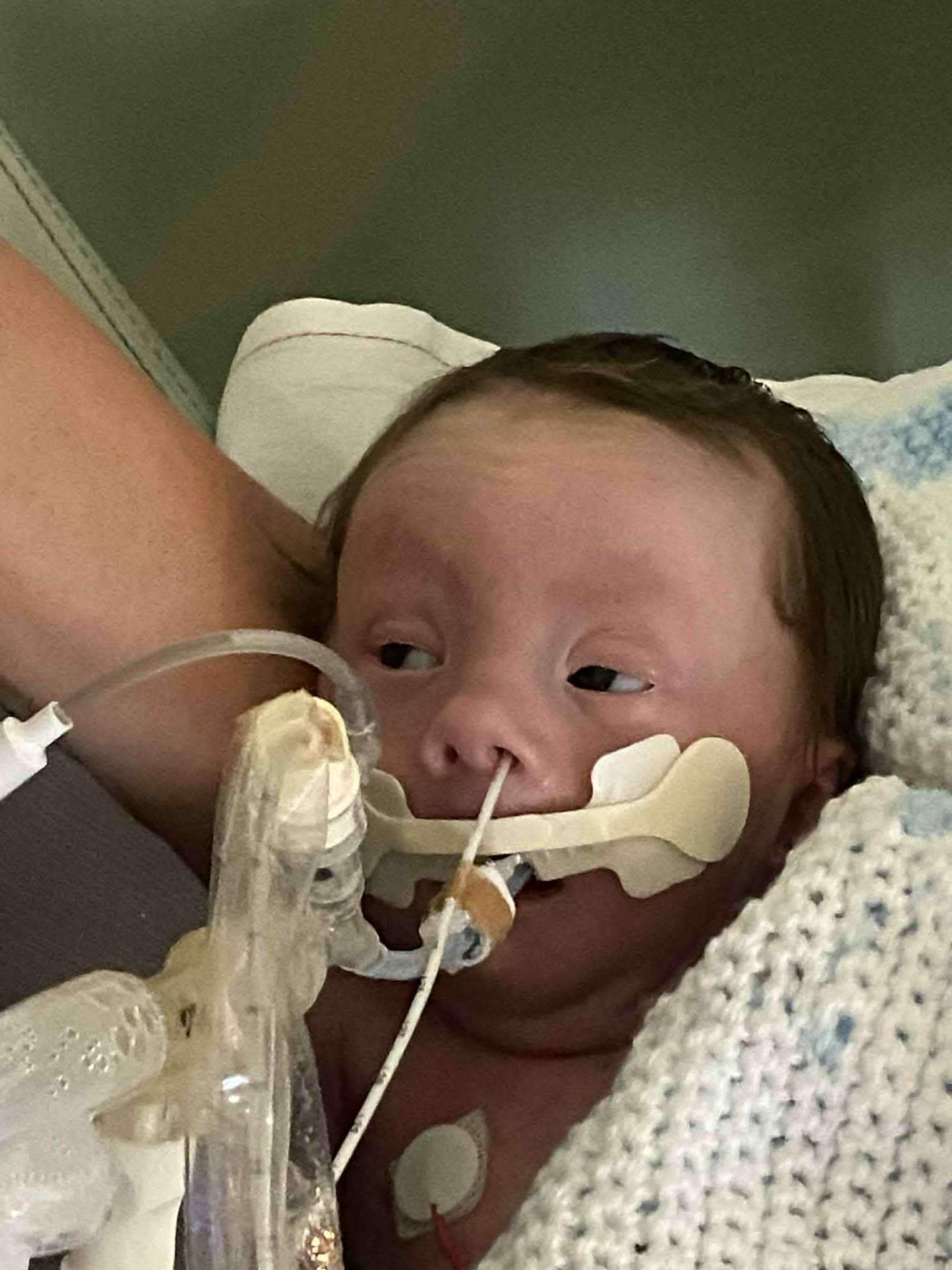 Close-up of Noah resting